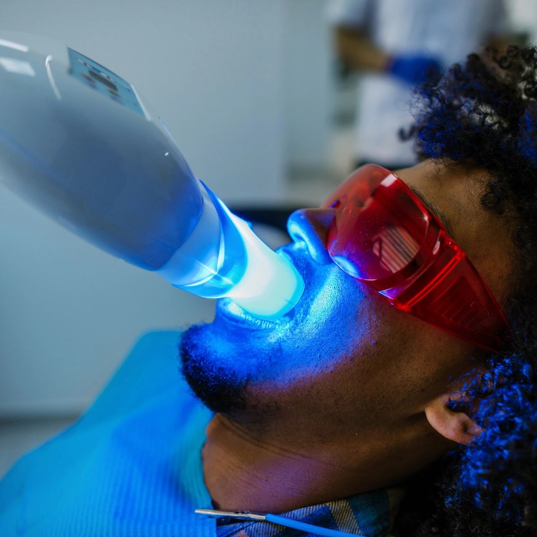 B’Yond White Teeth Whitening Teeth Whitening Memphis, Tennessee